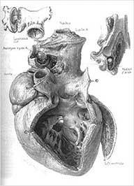 Ilustrações médicas pelo ilustrador médico Max Brödel - Coração